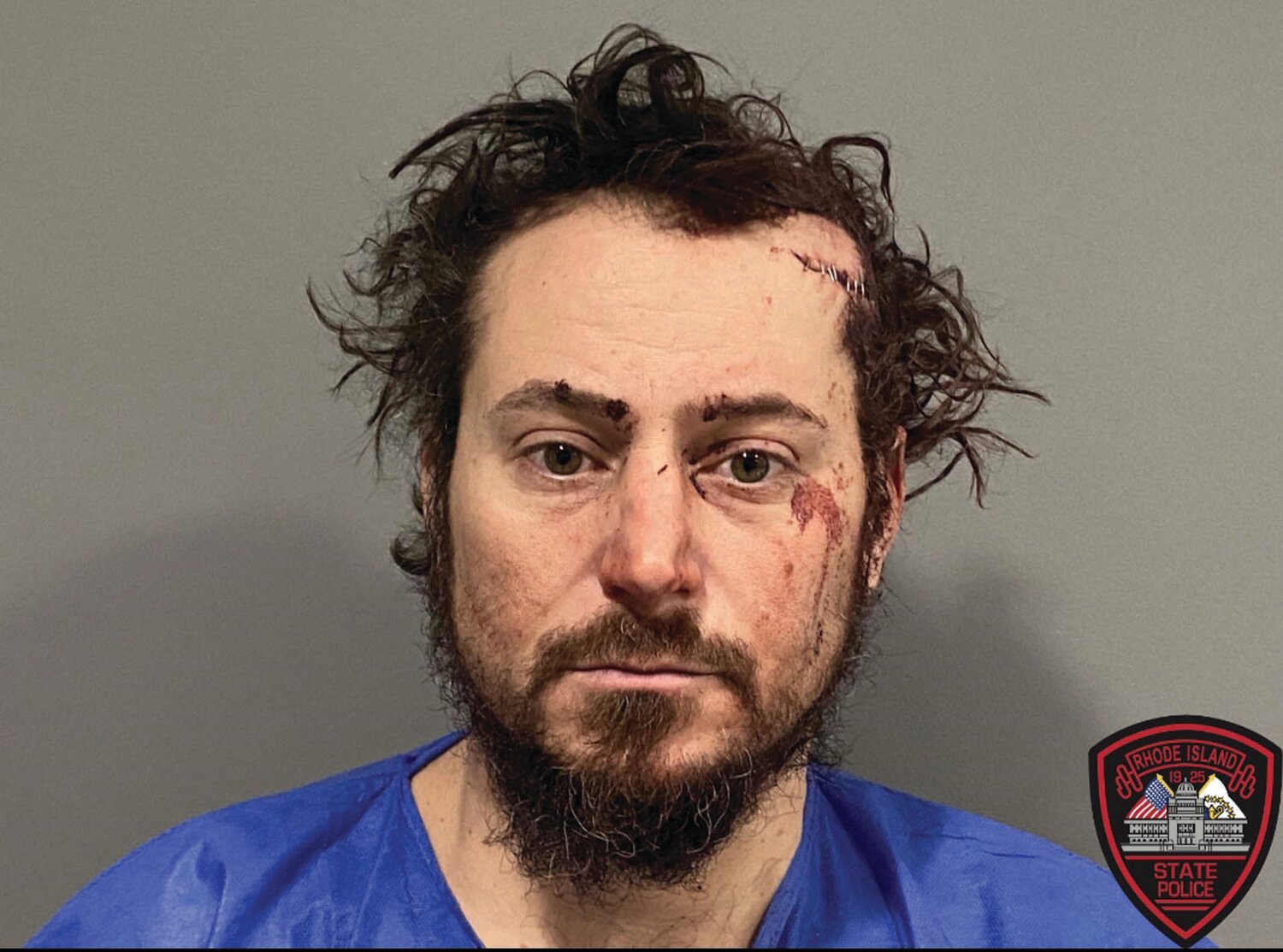 CHARGED: Joseph L. Giudici, 40, of 7 Canonchet Trail, Johnston, has been arrested and charged with Driving Under the Influence after he struck two marked Rhode Island State Police cruisers on Saturday night, sending two Troopers to the hospital, according to police. RISP provided photos from the Providence crash scene.